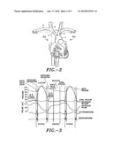 Method and system for determining cardiac performance diagram and image