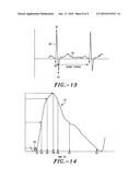 Method and system for determining cardiac performance diagram and image