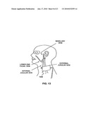 APPARATUS AND METHOD FOR NON-INVASIVE AND MINIMALLY-INVASIVE SENSING OF PARAMETERS RELATING TO BLOOD diagram and image