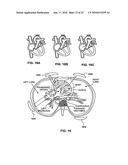 APPARATUS AND METHOD FOR NON-INVASIVE AND MINIMALLY-INVASIVE SENSING OF PARAMETERS RELATING TO BLOOD diagram and image