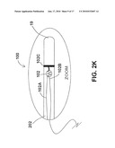 DEVICES, SYSTEMS, AND METHODS FOR MEASURING PARALLEL TISSUE CONDUCTANCE, LUMINAL CROSS-SECTIONAL AREAS, FLUID VELOCITY, AND/OR DETERMINING PLAQUE VULNERABILITY USING TEMPERATURE diagram and image