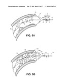 DEVICES, SYSTEMS, AND METHODS FOR MEASURING PARALLEL TISSUE CONDUCTANCE, LUMINAL CROSS-SECTIONAL AREAS, FLUID VELOCITY, AND/OR DETERMINING PLAQUE VULNERABILITY USING TEMPERATURE diagram and image