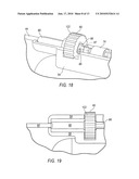 TISSUE REMOVAL DEVICE FOR NEUROSURGICAL AND SPINAL SURGERY APPLICATIONS diagram and image