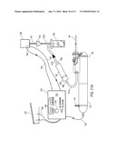 TISSUE REMOVAL DEVICE FOR NEUROSURGICAL AND SPINAL SURGERY APPLICATIONS diagram and image