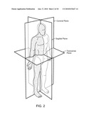 PELVIS INTERFACE diagram and image