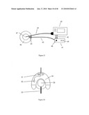 METHOD AND DEVICE FOR DRUG DELIVERY diagram and image