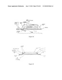 METHOD AND DEVICE FOR DRUG DELIVERY diagram and image