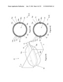 INFLATABLE MEDICAL DEVICES diagram and image