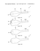 INFLATABLE MEDICAL DEVICES diagram and image