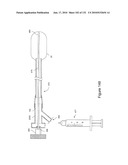 INFLATABLE MEDICAL DEVICES diagram and image