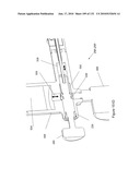 INFLATABLE MEDICAL DEVICES diagram and image