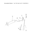 INFLATABLE MEDICAL DEVICES diagram and image