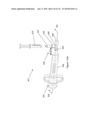 INFLATABLE MEDICAL DEVICES diagram and image