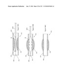 INFLATABLE MEDICAL DEVICES diagram and image