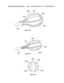 INFLATABLE MEDICAL DEVICES diagram and image