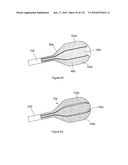 INFLATABLE MEDICAL DEVICES diagram and image