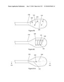 INFLATABLE MEDICAL DEVICES diagram and image