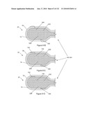 INFLATABLE MEDICAL DEVICES diagram and image