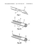 Stylet for bilumenal flexible medical device diagram and image