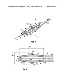 METHOD FOR DELIVERING MEDICATION INTO AN ARTERIAL WALL FOR PREVENTION OF RESTENOSIS diagram and image