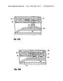 METHOD FOR DELIVERING MEDICATION INTO AN ARTERIAL WALL FOR PREVENTION OF RESTENOSIS diagram and image