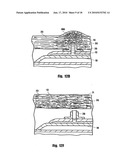 METHOD FOR DELIVERING MEDICATION INTO AN ARTERIAL WALL FOR PREVENTION OF RESTENOSIS diagram and image