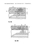 METHOD FOR DELIVERING MEDICATION INTO AN ARTERIAL WALL FOR PREVENTION OF RESTENOSIS diagram and image