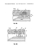 METHOD FOR DELIVERING MEDICATION INTO AN ARTERIAL WALL FOR PREVENTION OF RESTENOSIS diagram and image