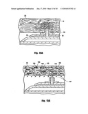 METHOD FOR DELIVERING MEDICATION INTO AN ARTERIAL WALL FOR PREVENTION OF RESTENOSIS diagram and image