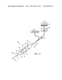 METHOD FOR DELIVERING MEDICATION INTO AN ARTERIAL WALL FOR PREVENTION OF RESTENOSIS diagram and image