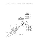 METHOD FOR DELIVERING MEDICATION INTO AN ARTERIAL WALL FOR PREVENTION OF RESTENOSIS diagram and image