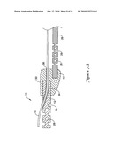 OFFSET COUPLING REGION diagram and image