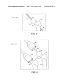 HEAD CENTERING JIG FOR FEMORAL RESURFACING diagram and image