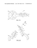 HEAD CENTERING JIG FOR FEMORAL RESURFACING diagram and image