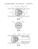 BODY LUMEN FILTERS WITH STRUCTURES TO REDUCE PARTICULATES AND METHODS FOR FILTERING A BODY LUMEN diagram and image
