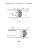 BODY LUMEN FILTERS WITH STRUCTURES TO REDUCE PARTICULATES AND METHODS FOR FILTERING A BODY LUMEN diagram and image