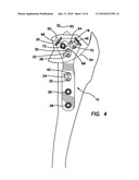 Universal Surgical Plate with 30 Degree Compression Angle diagram and image