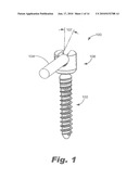 PEDICLE SCREW SYSTEM WITH PROVISIONAL LOCKING ASPECTS diagram and image