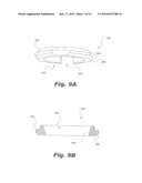 PEDICLE SCREW SYSTEM WITH PROVISIONAL LOCKING ASPECTS diagram and image