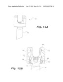 PEDICLE SCREW SYSTEM WITH PROVISIONAL LOCKING ASPECTS diagram and image