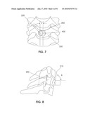 TRANSCORPOREAL SPINAL DECOMPRESSION AND REPAIR SYSTEMS AND RELATED METHODS diagram and image