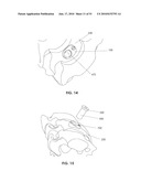 TRANSCORPOREAL SPINAL DECOMPRESSION AND REPAIR SYSTEMS AND RELATED METHODS diagram and image