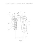 TRANSCORPOREAL SPINAL DECOMPRESSION AND REPAIR SYSTEMS AND RELATED METHODS diagram and image