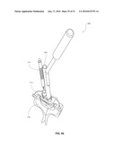 TRANSCORPOREAL SPINAL DECOMPRESSION AND REPAIR SYSTEMS AND RELATED METHODS diagram and image