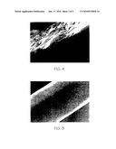 Intraluminar perforated radially expandable drug delivery prosthesis and a method for the production thereof diagram and image