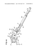 PROSTHETIC IMPLANT WITH BIPLANAR ANGULATION AND COMPOUND ANGLES diagram and image