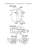 PROSTHETIC IMPLANT WITH BIPLANAR ANGULATION AND COMPOUND ANGLES diagram and image