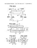 PROSTHETIC IMPLANT WITH BIPLANAR ANGULATION AND COMPOUND ANGLES diagram and image