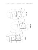 Single Use Sterilization Container diagram and image