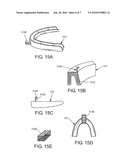 INTRA-ORAL APNEA AND SNORING PREVENTIONG APPLIANCE diagram and image